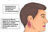 Саратовские медики назвали 3 опасных симптома после травмы головы